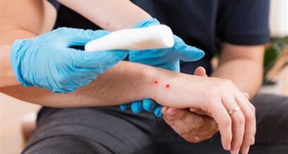 close up of someone giving first aid to a cut on an arm of another person